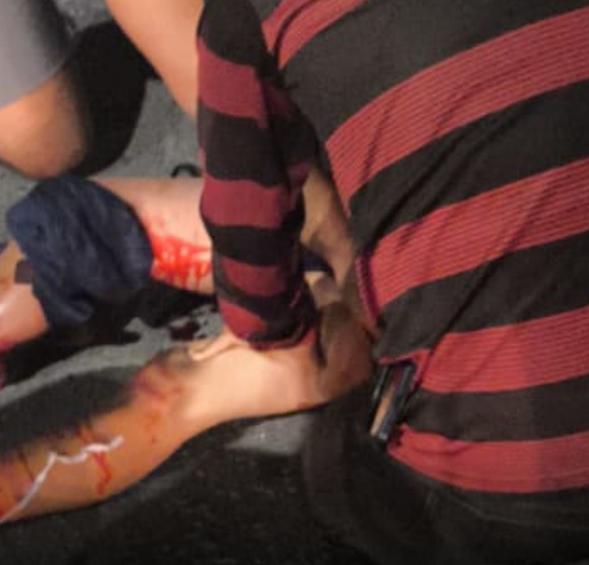 Criança perde o pé ao ser atropelada enquanto brincava de pipa no Novo Aleixo