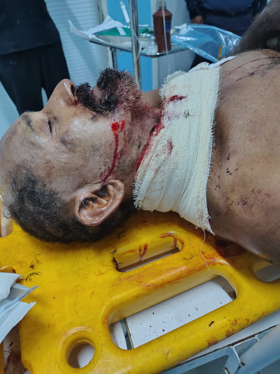 Criminosos atacam idoso a golpes de terçado no pescoço em Manacapuru