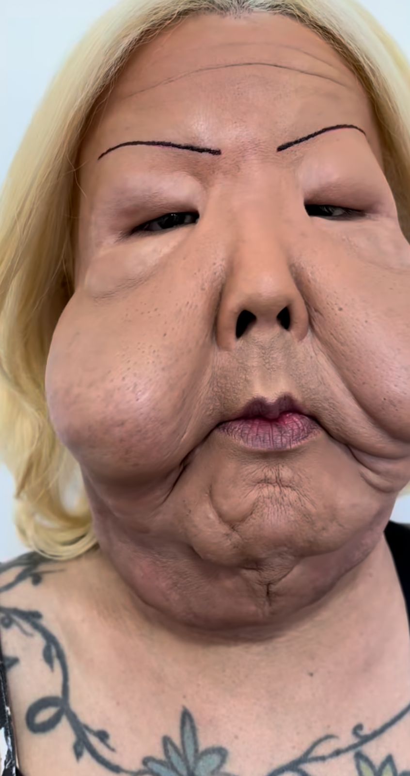 "Juju do pix" inicia jornada de reparação após deformação por óleo mineral no rosto