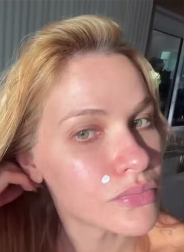 Andressa Suita desabafa sobre pele "ruim": "realidade de quem está tentando engravidar"