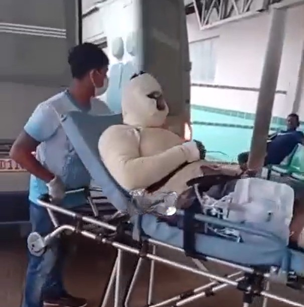 Funcionário tem parte do corpo queimado durante explosão em empresa em Itacoatiara