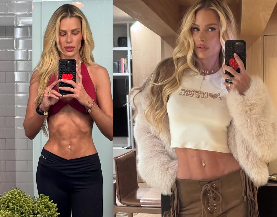 Yasmin Brunet lamenta críticas após emagrecer para tratar lipedema: 'cracuda, anoréxica'