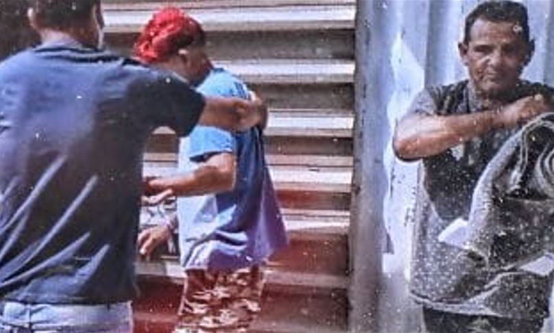 Vítima de acidente no Festival de Cirandas de Manacapuru deixa hospital em Manaus