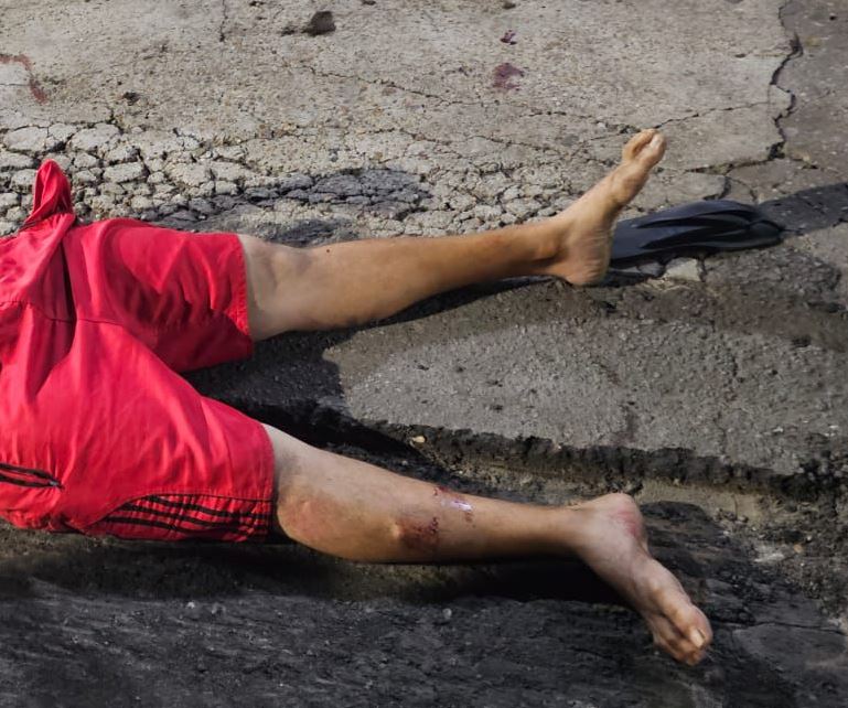 Homem leva três tiros enquanto caminhava em rua na Compensa