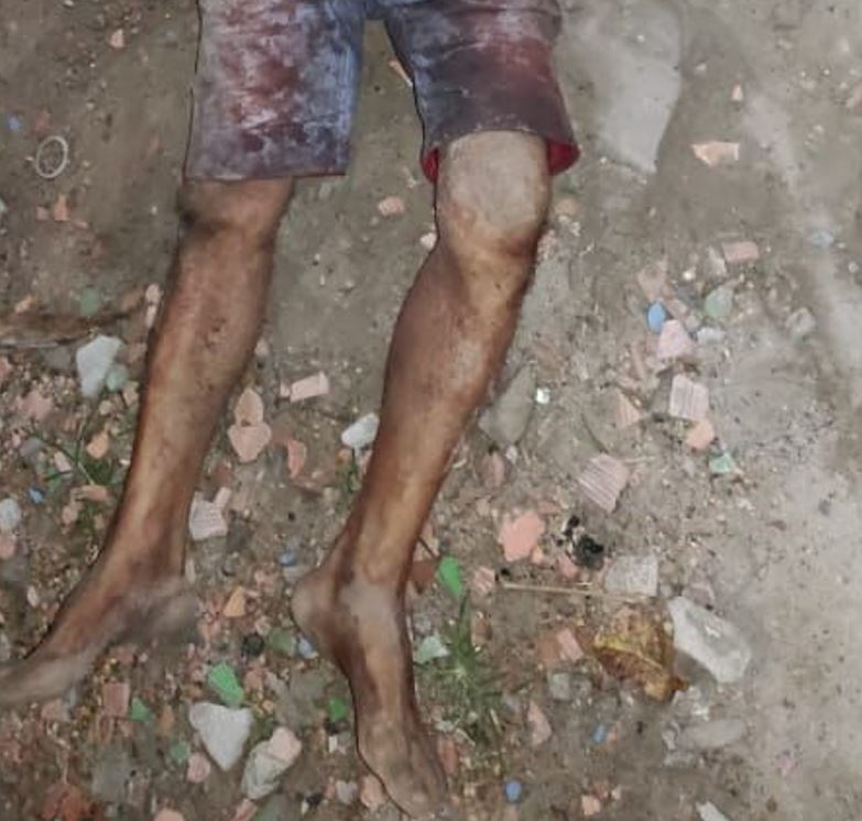 PM encontra homem morto após ser linchado na rua de casa em Manaus