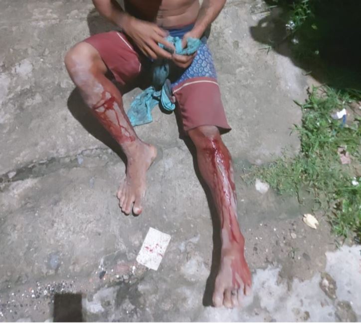 Homem é sequestrado e torturado no quintal de casa em Manaus