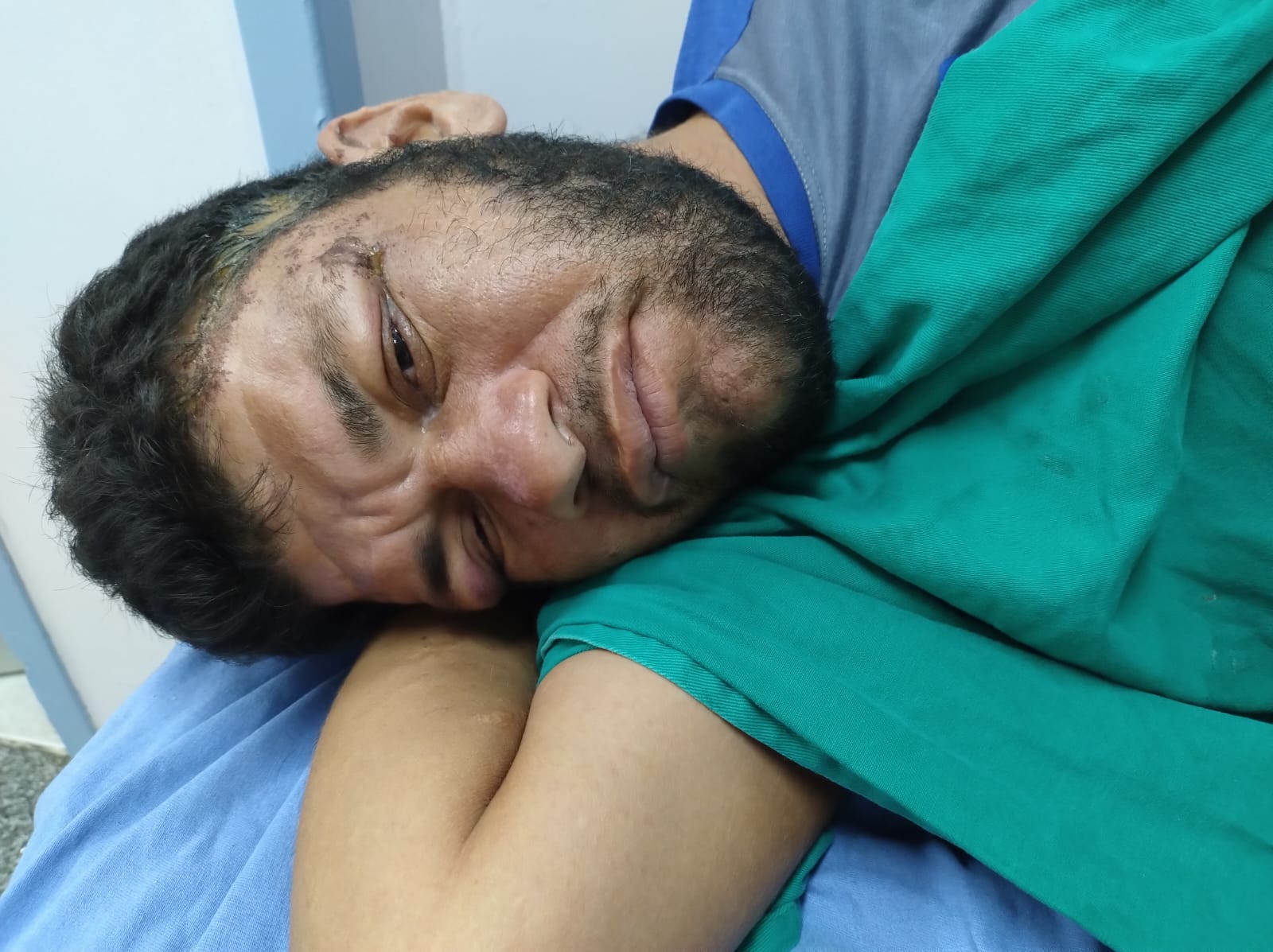 Hospital João Lúcio procura familiares de paciente internado por atropelamento