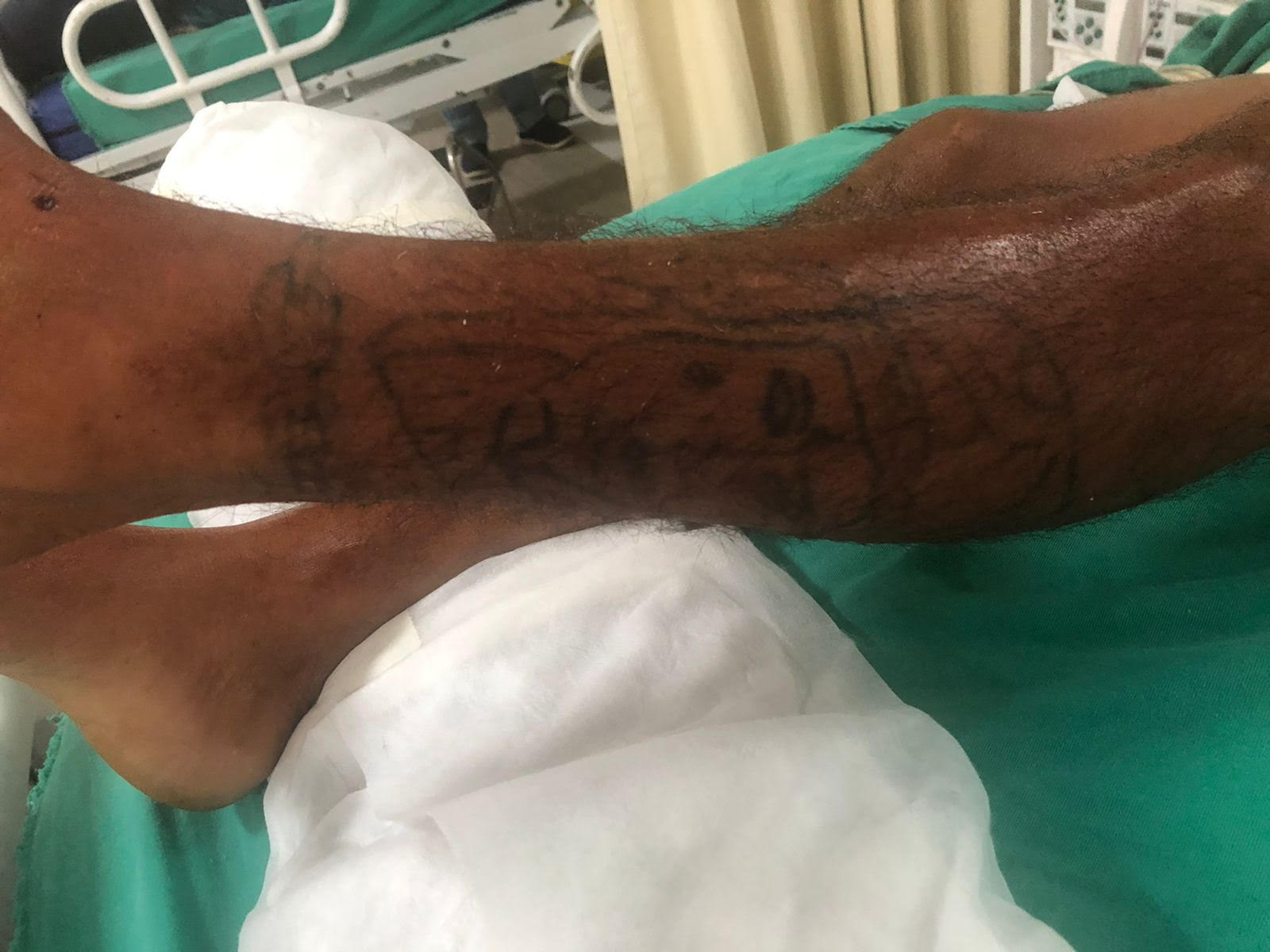 Hospital de Manaus pede ajuda para localizar família de paciente inconsciente em UTI