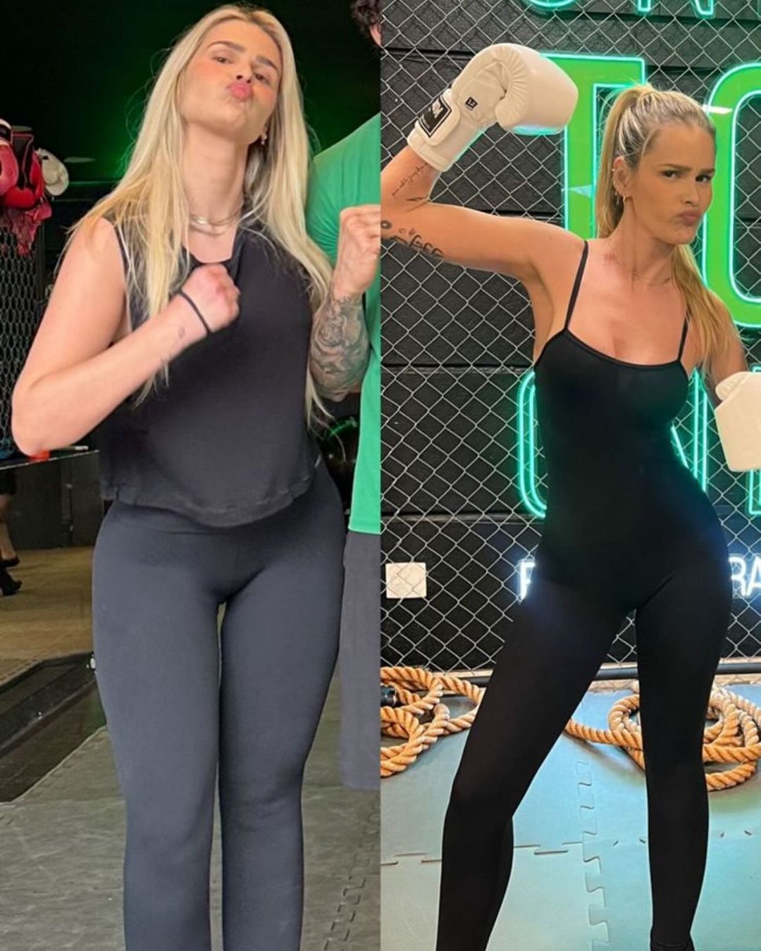 Yasmin Brunet rebate críticas sobre corpo e rosto durante tratamento de lipedema; fotos