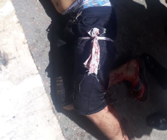 Homem é baleado em plena luz do dia em área vermelha em Manaus