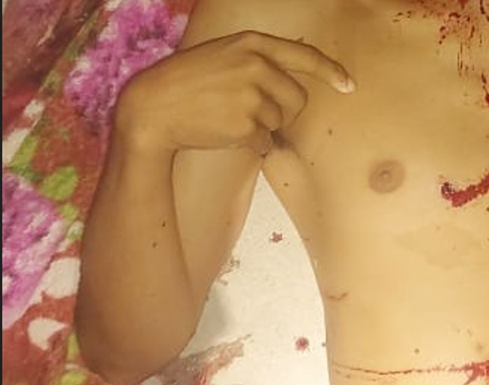 Homem morre ao ter cabeça destruída a tiro na frente da esposa em Manaus