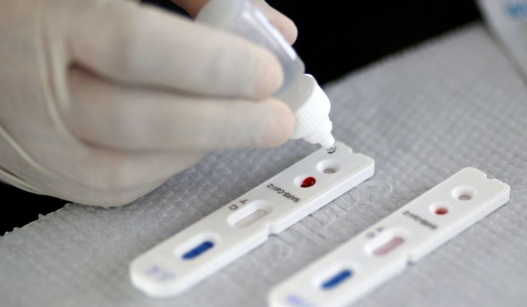 Amazonas registra 101 novos casos de Covid-19 em 24h