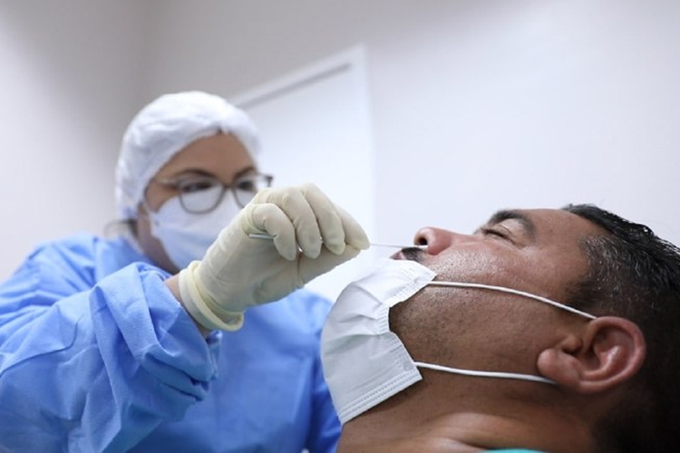 Covid-19: Brasil notifica 365 óbitos e 72 mil casos em 24 horas