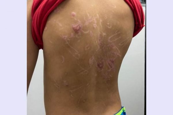 Menino de 8 anos é torturado pelo próprio pai e faz relato chocante
