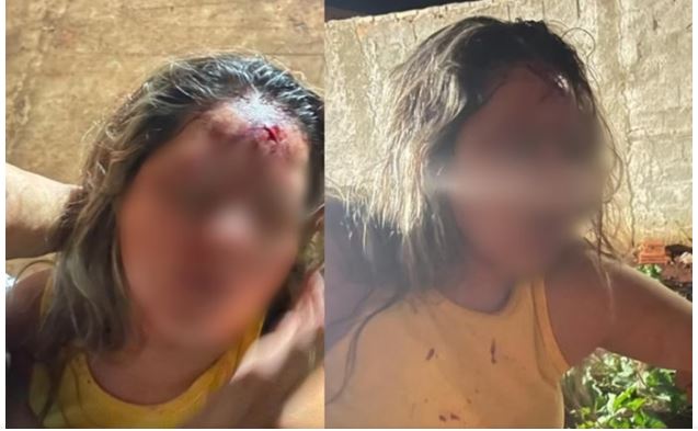 Sertanejo bate cabeça de namorada diversas vezes em parede e acaba preso