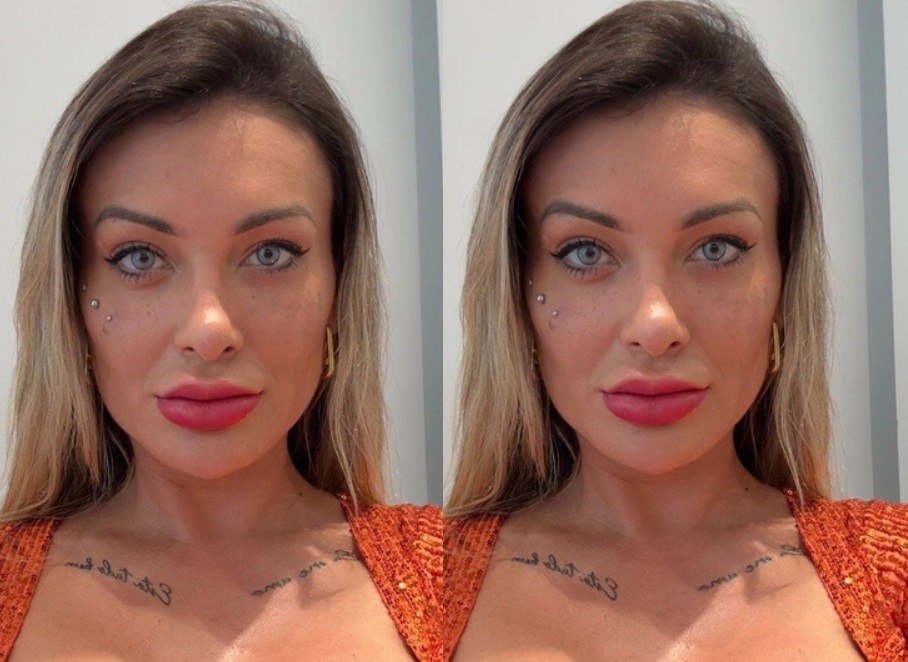 Andressa Urach relata fortes dores após cirurgia para mudar cor dos olhos