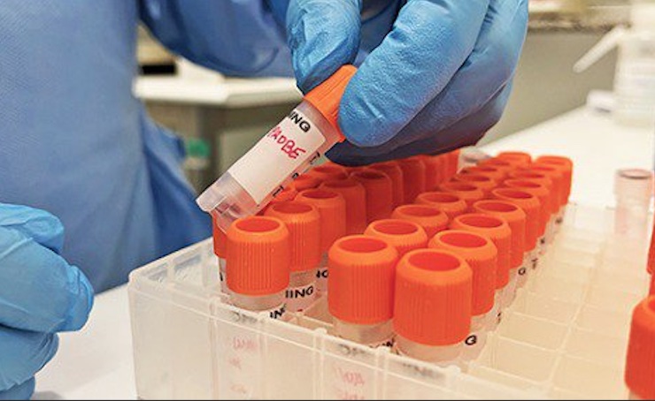 Manaus finaliza plano de contingência para o manejo de casos de varíola dos macacos