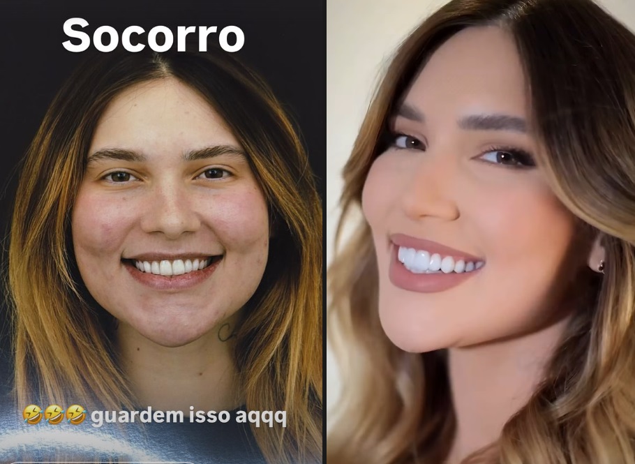 Virgínia Fonseca troca lentes dos dentes e mostra resultado 