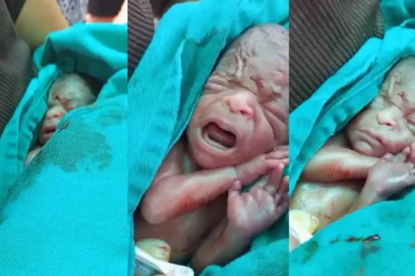 Bebê resgatado de dentro de caixão após chorar em velório morre no Acre