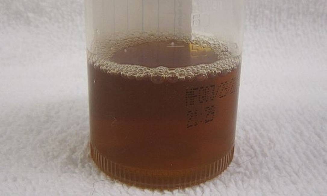 Após comer peixe, irmãs são internadas em Recife com doença da urina preta