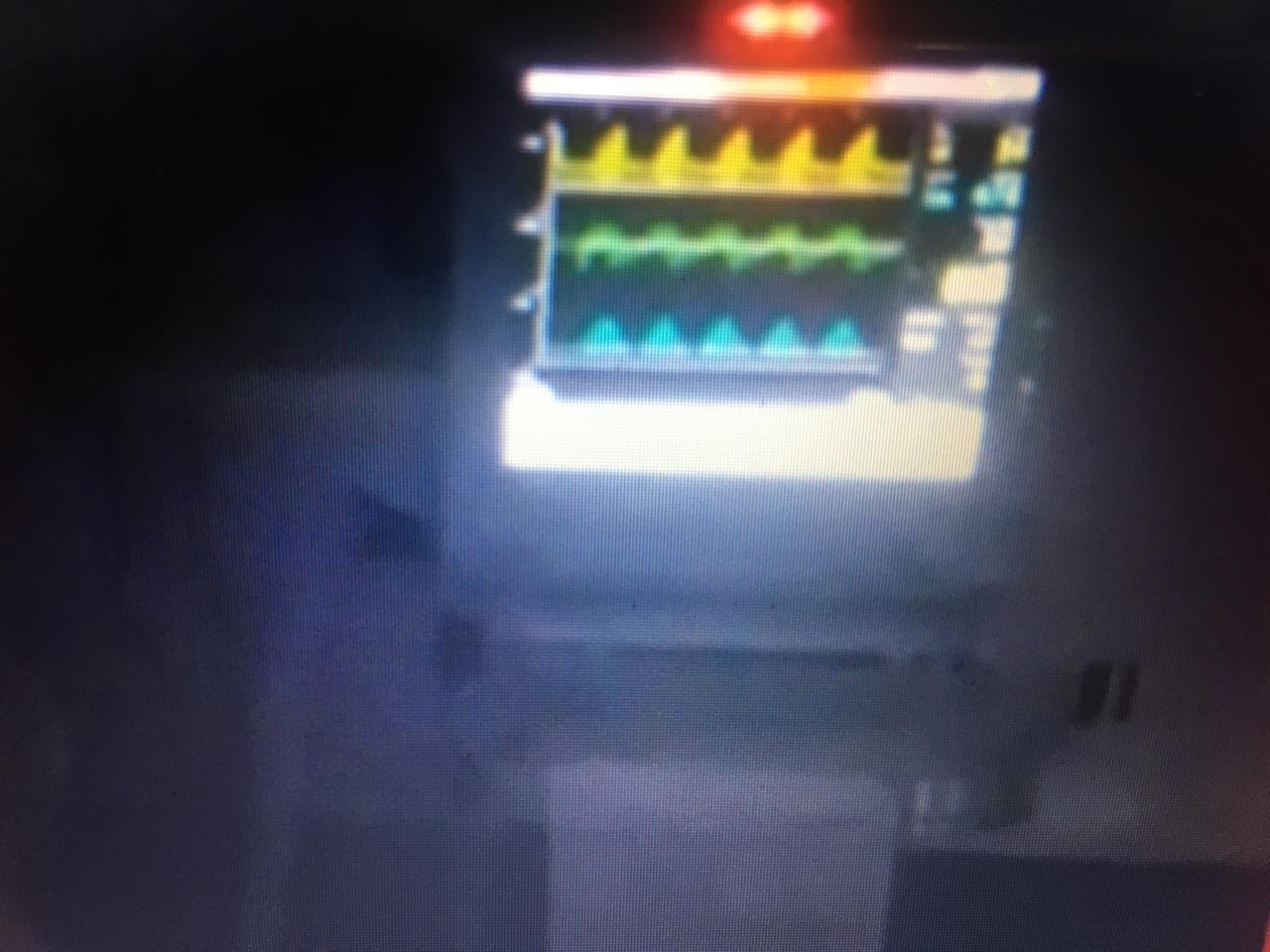 Trabalhadores de folga vão a hospital para ventilar manualmente pacientes