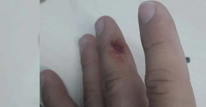 Mulher ataca policial a mordida ao tentar impedir prisão de sobrinho em Manaus