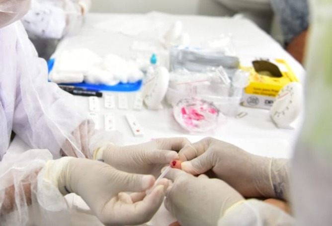 Anvisa aprova novo medicamento para tratamento da HIV