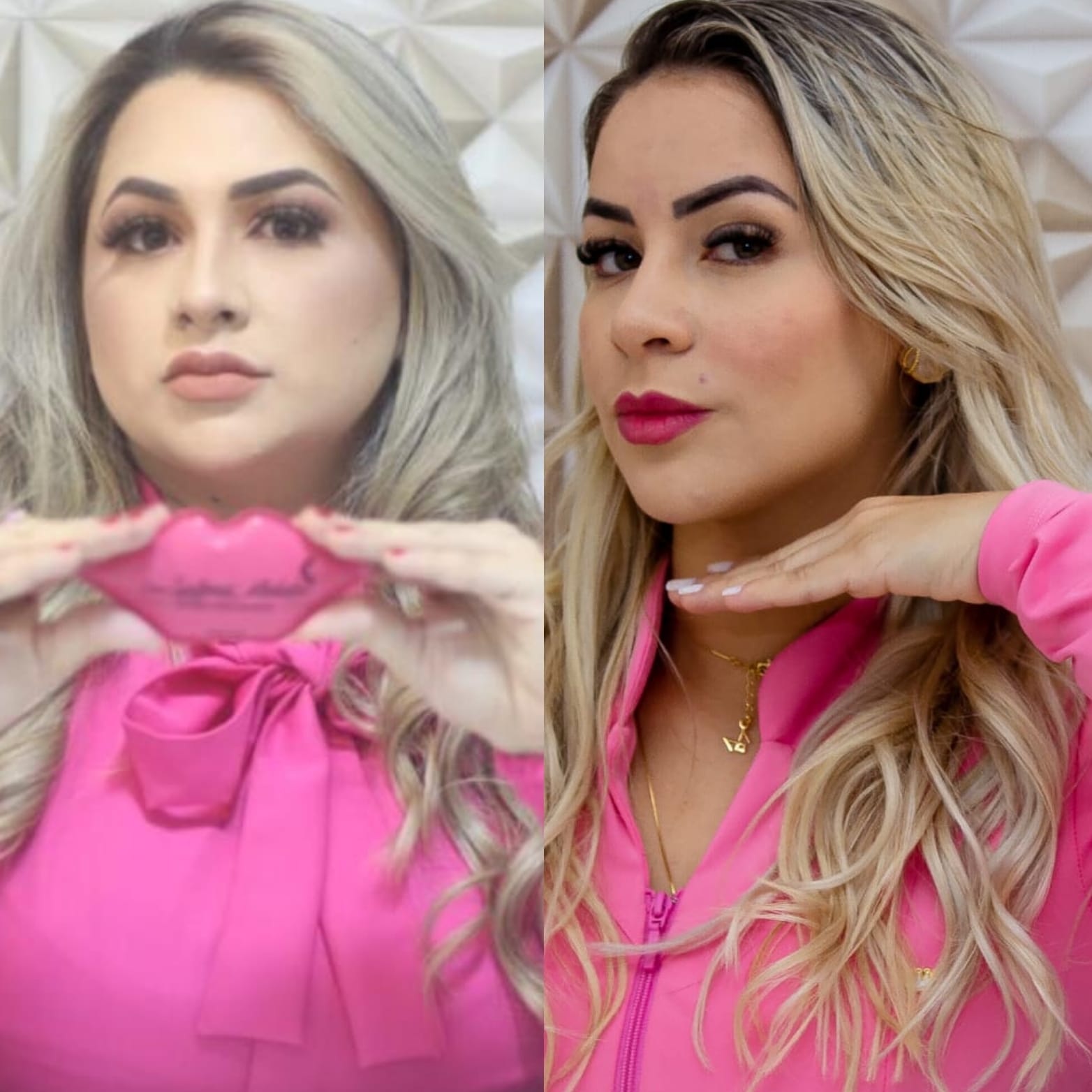 Harmonização facial: como o procedimento está sendo usado para melhorar a saúde mental