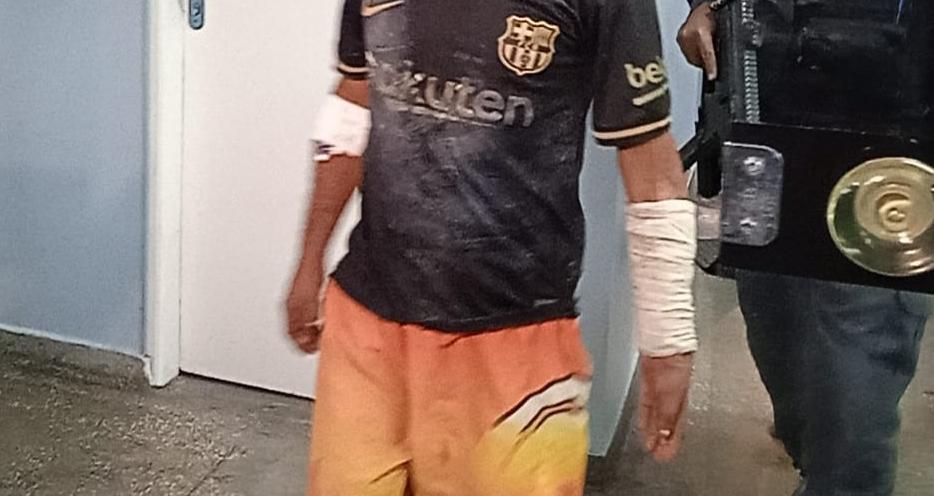 Prestes a ser esquartejado, homem é salvo de tribunal do crime em Manaus; 2 suspeitos morreram