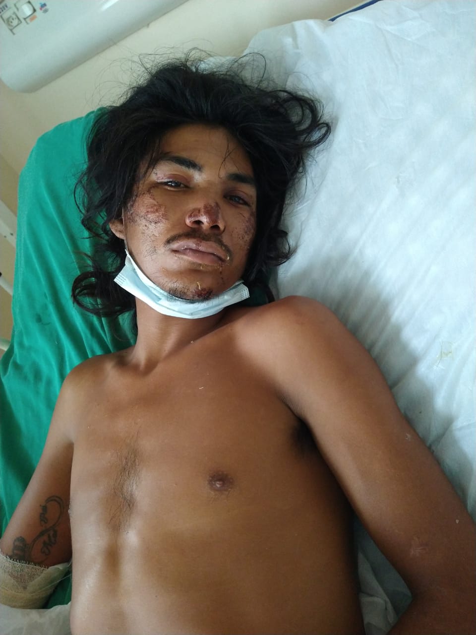 Hospital João Lúcio procura familiares de homem espancado em Manaus