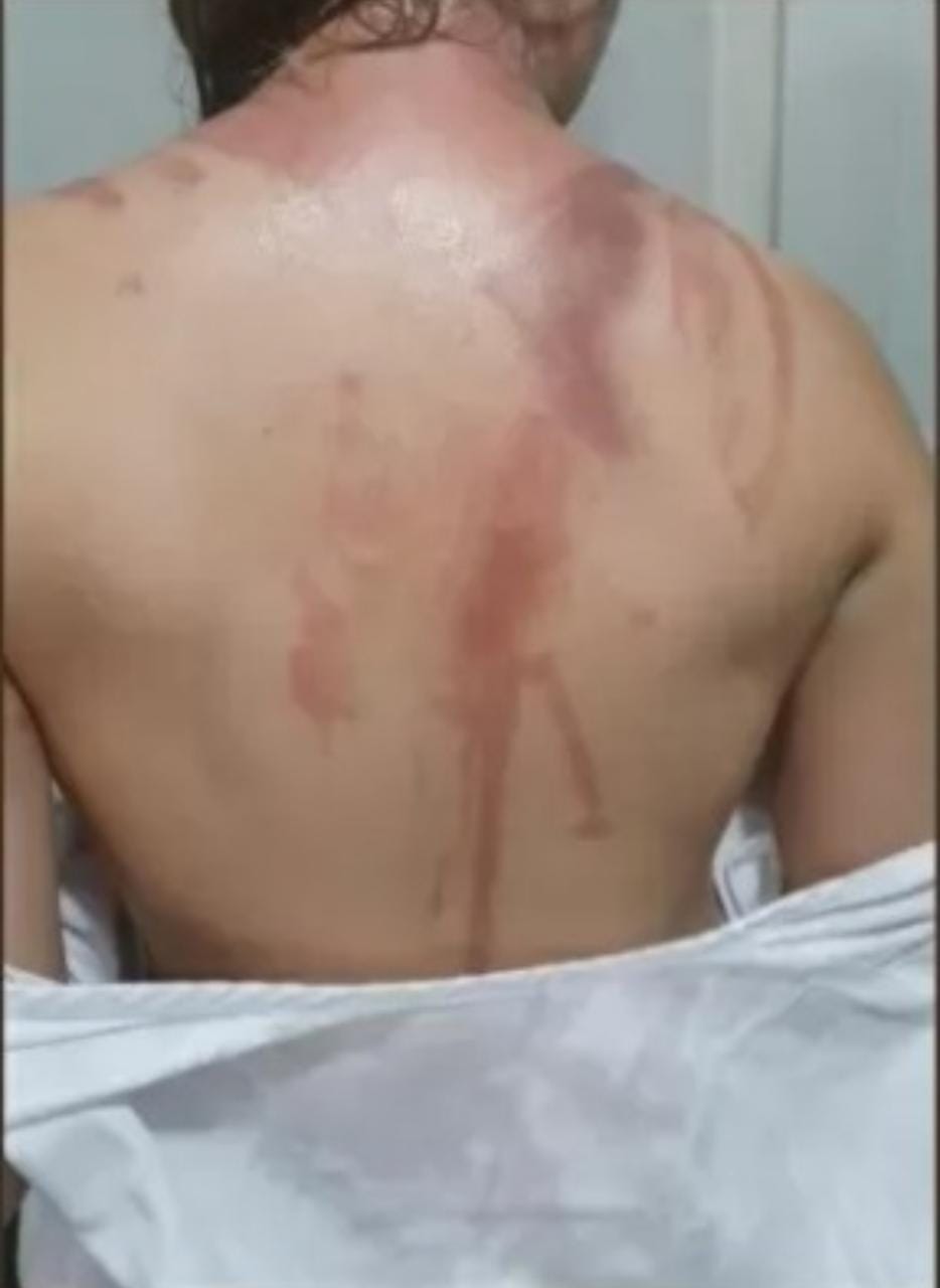 Envolvidos em trote de Universidade que deixou 20 queimados são liberados de prisão