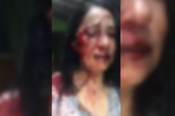 Mulher é espancada por 9 vizinhos após denúncia de som alto 