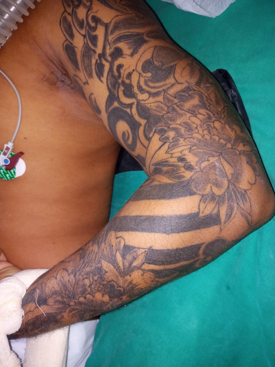 Hospital João Lúcio busca família de paciente internado atingido por tiro