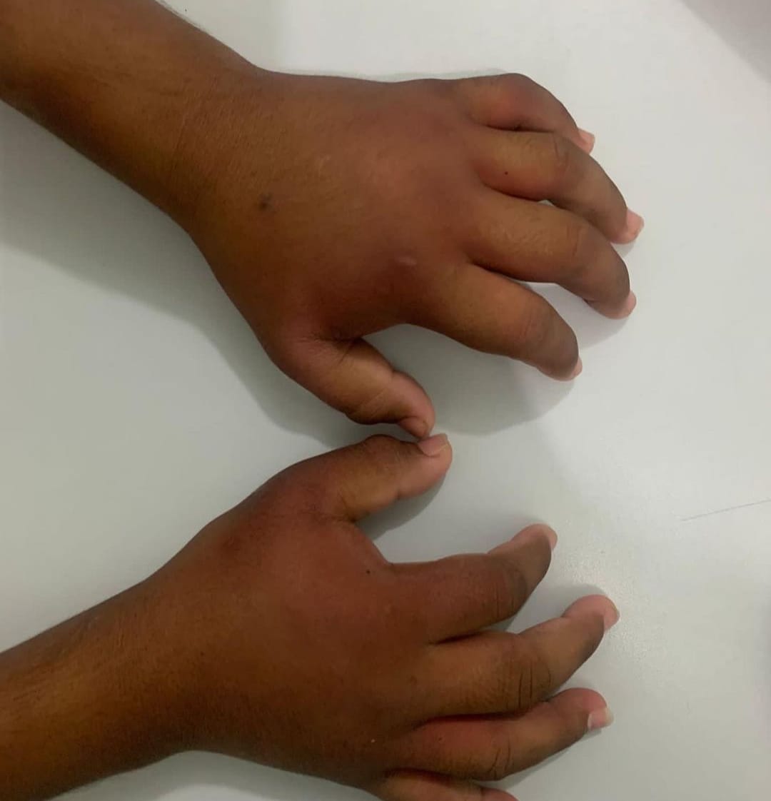 Criança urina sangue e leva diversas ripadas após tortura por pai em Manaus