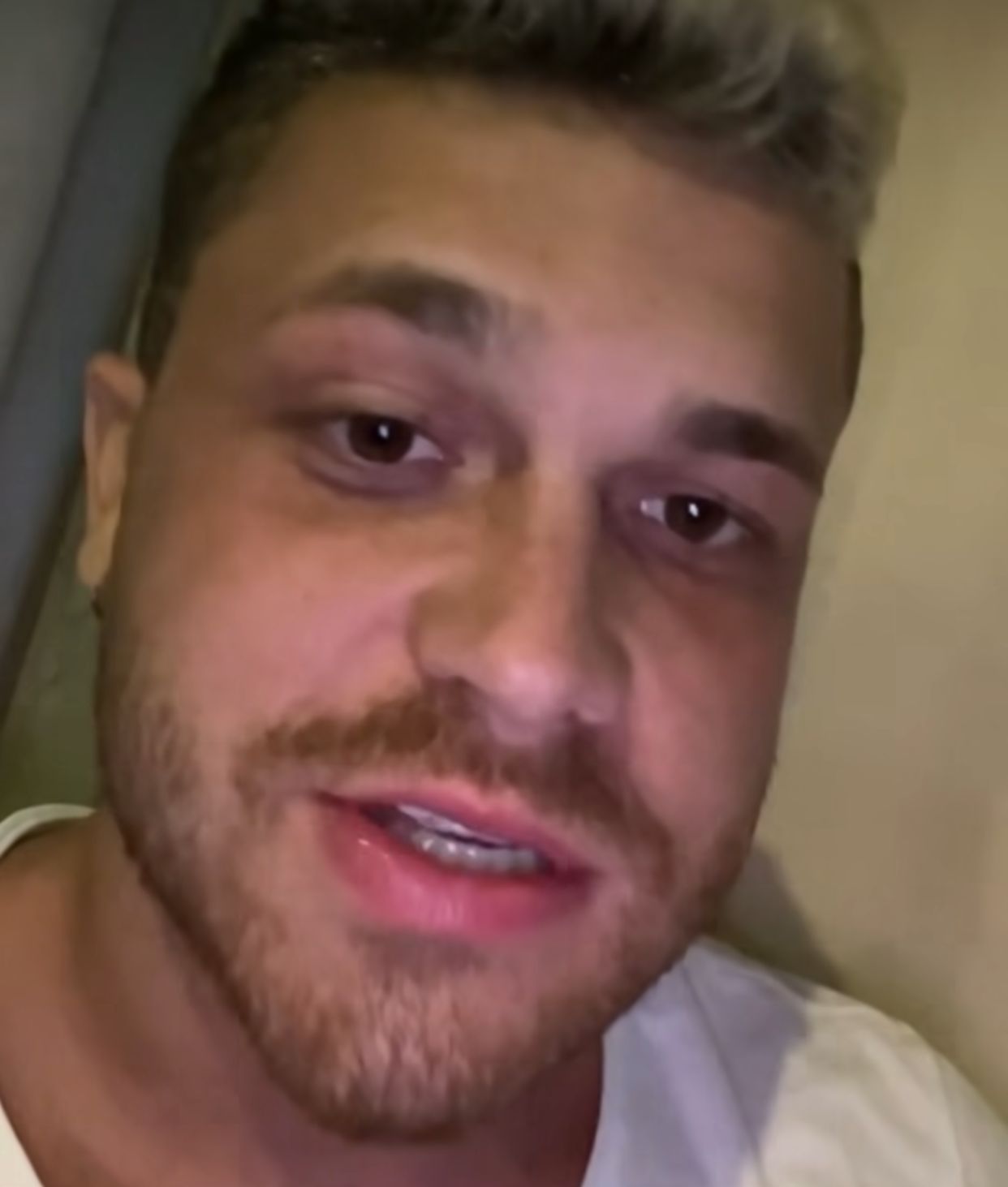 Influencer Gustavo Tubarão sofre paralisia facial e relata desespero: 'pensei que era AVC’