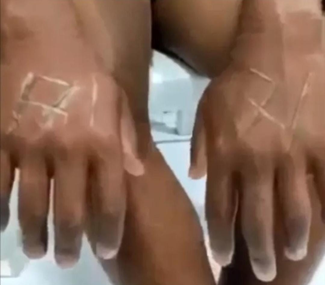 Funcionários são torturados por patrões com pauladas e ferro quente após 'sumiço' de R$ 30