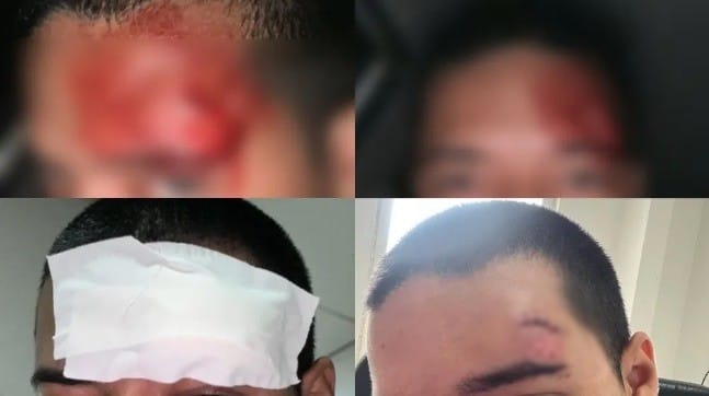 Estudante da Ufam sofre corte na cabeça após pular de ônibus para fugir de assalto em Manaus