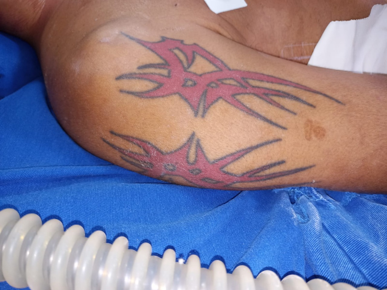 Hospital pede ajuda para encontrar família de homem espancado em Manaus