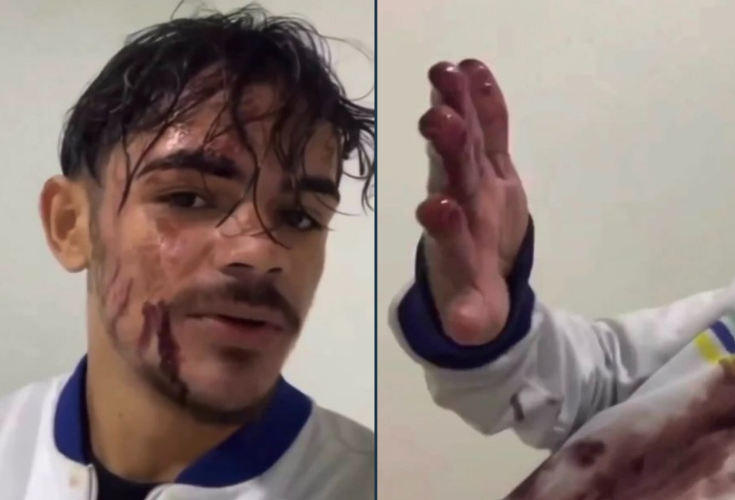 Cliente joga pote de açaí em motoboy por demora em entrega: "estava chovendo"