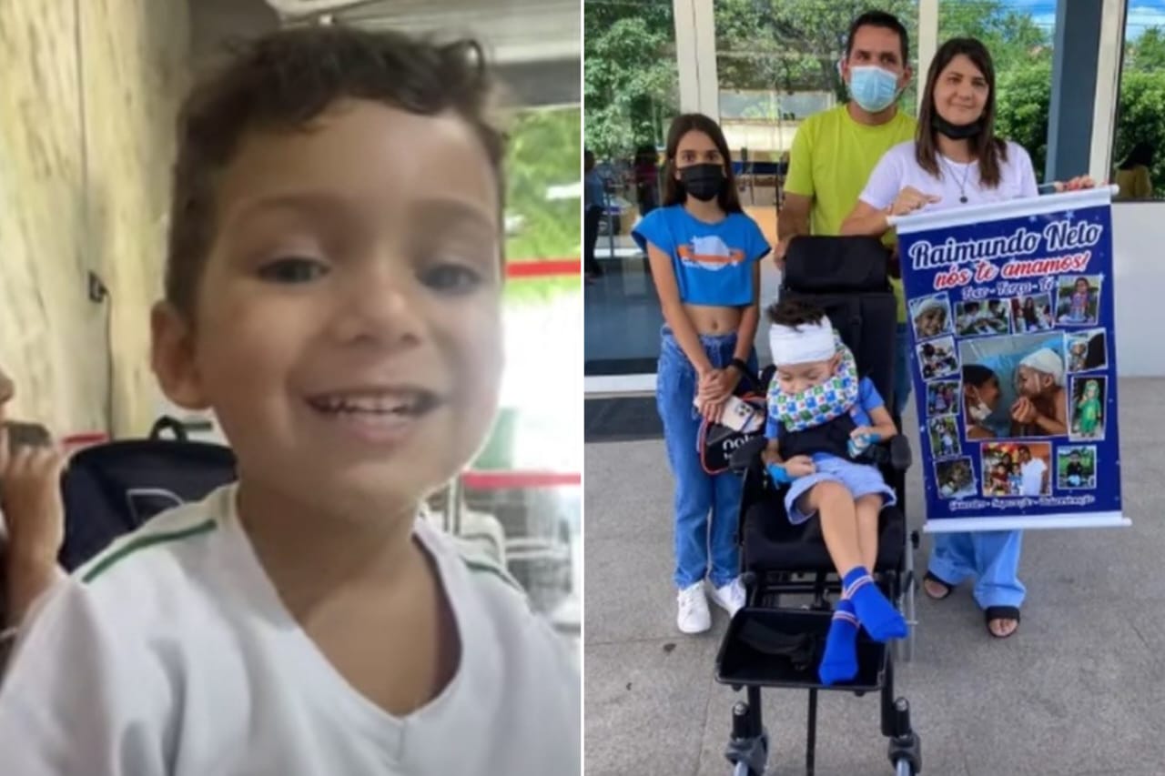 Criança perde a visão e o movimento das pernas após ser picada por escorpião