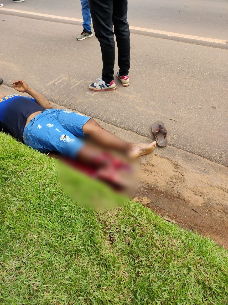 Motociclista fica com fratura exposta após acidente com carro em Iranduba 