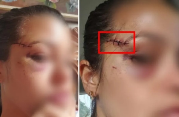 Policial federal baleada por Roberto Jefferson pede indenização milionária 