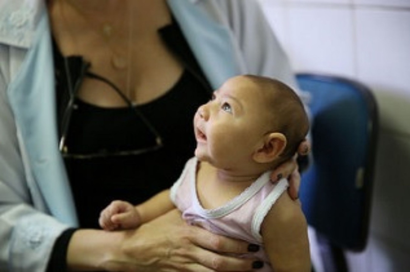 Estudo sobre zika vírus aponta queda no nascimento de bebês com microcefalia