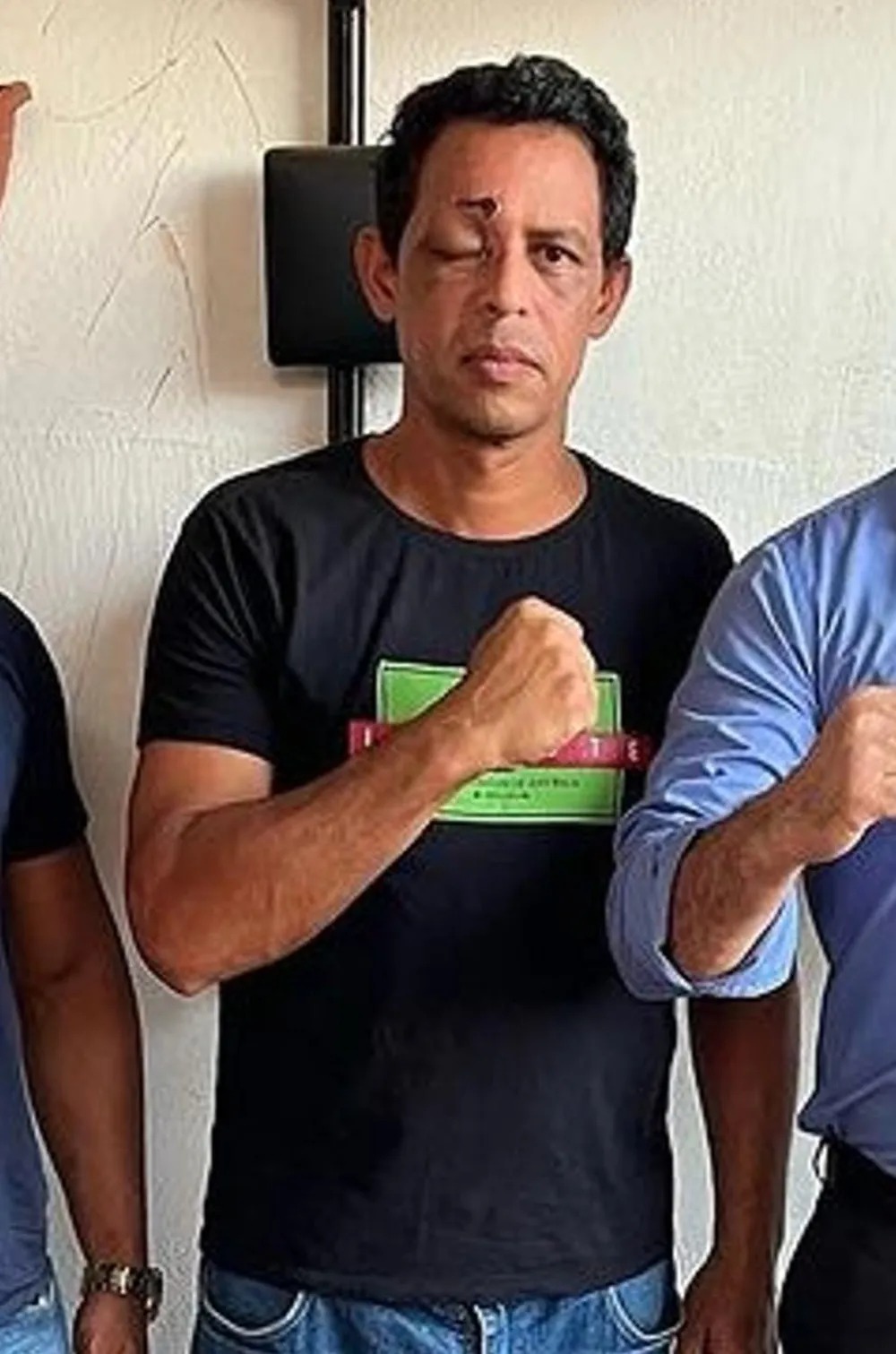 Policial que levou tiro no olho em rebelião em presídio do Acre faz campanha para tratamento