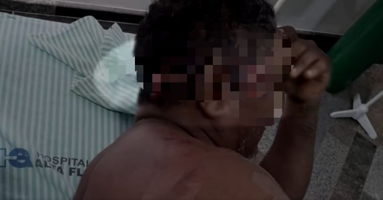 Indígena tem cabeça retalhada por onça-pintada