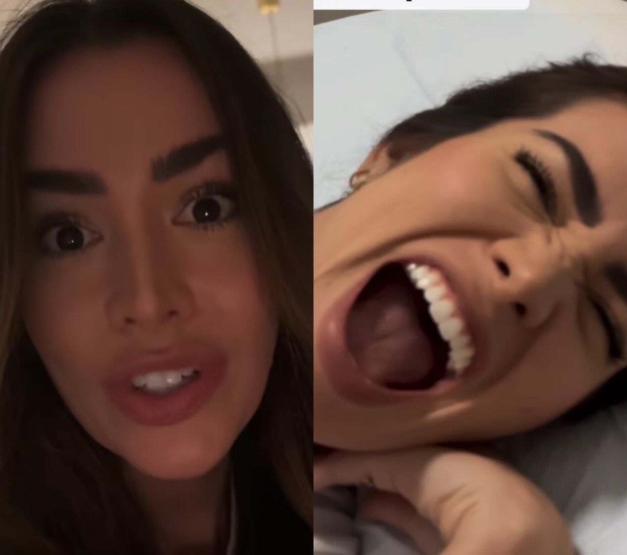 Ex-BBB Adriana Sant‘Anna faz procedimento para 'tirar cocô velho' do intestino; prática é contraindicada