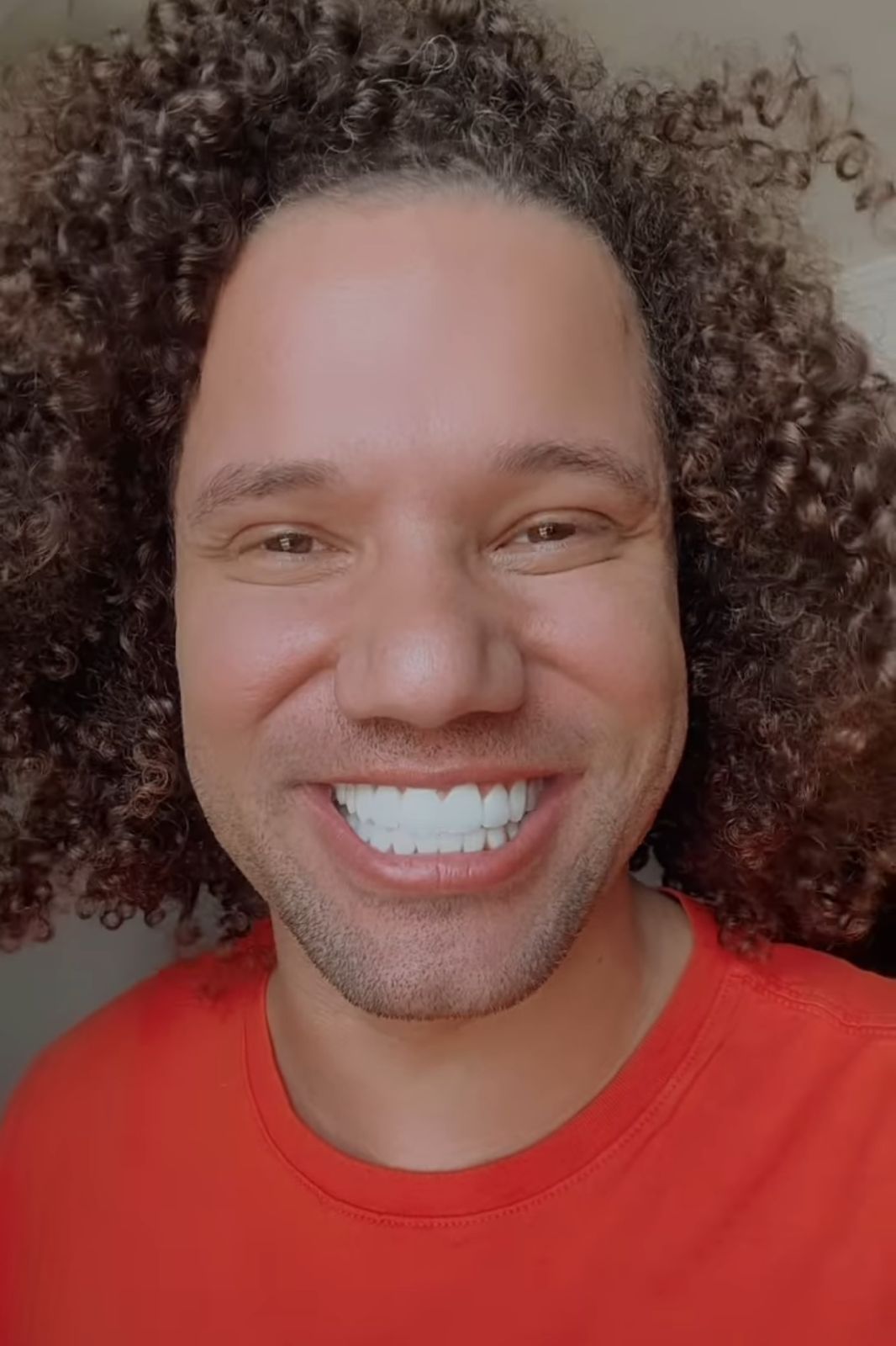 Ex-BBB Maycon celebra resultado de lipoaspiração e enxerto no bumbum 