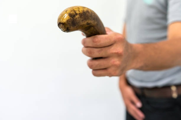 Homem procura tratamento após 17 anos com vermes no pênis