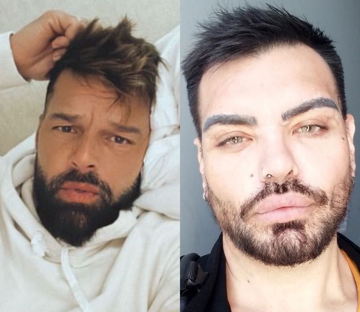 Fã que gastou milhões para ficar parecido com Ricky Martin se frustra com resultado