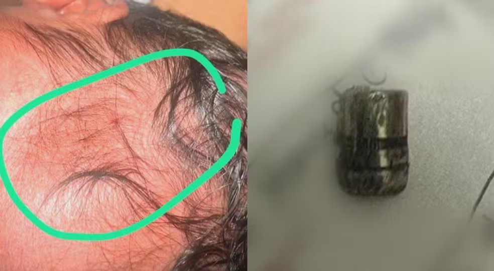 Recém-nascida é atingida por tiro em hospital  4 horas após o nascimento